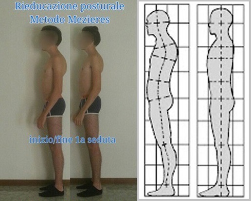 Postura pre e post-trattamento